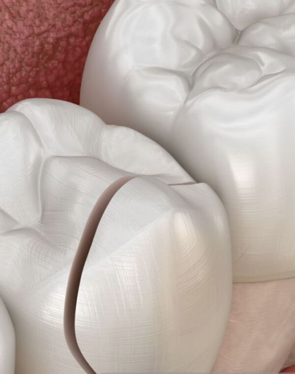 Referring Doctors Endodontics of Greater St. Louis